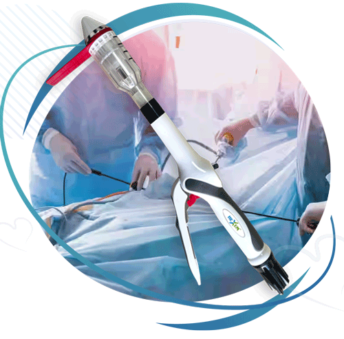 MIPH Stapler Manufacturers in Ahmedabad