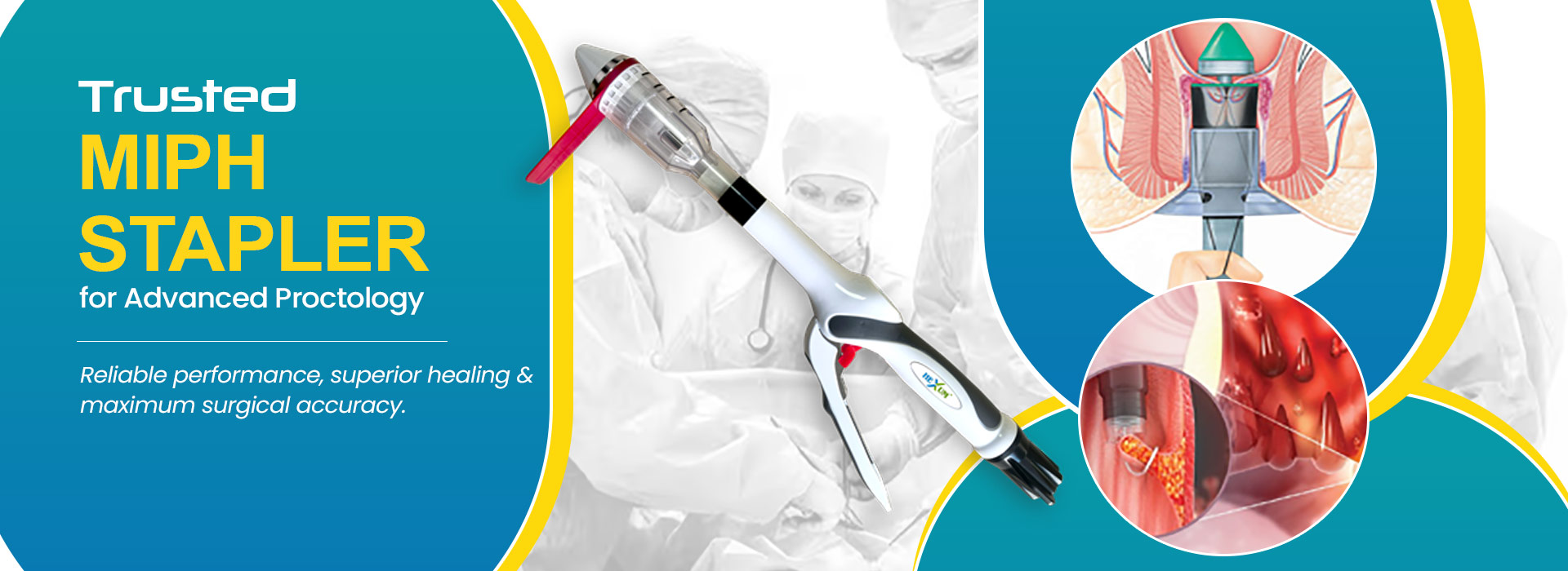 MIPH Stapler